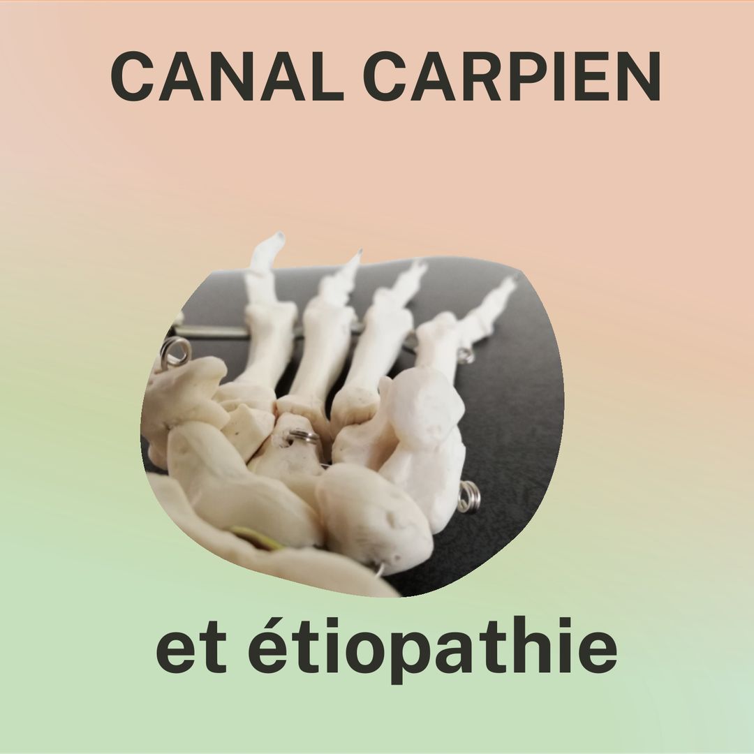 Canal carpien et étiopathie. Photo d'un squelette de main vu de profil, sur lequel on distingue les petits os du carpe.