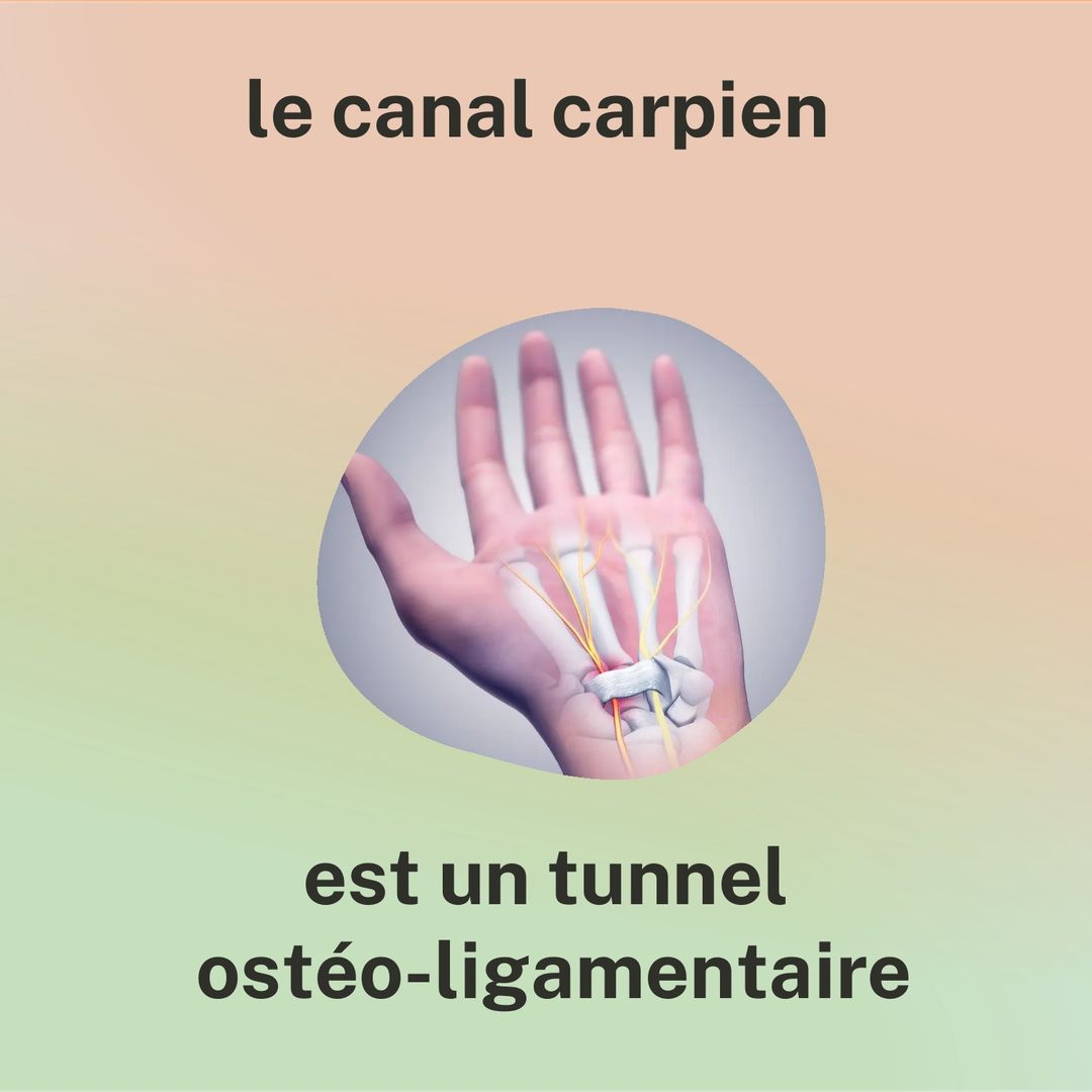 Le canal carpien est un tunnel ostéo-ligamentaire. Illustration d'une main vue de face, avec le ligament qui forme le toit du tunnel au niveau du poignet.
