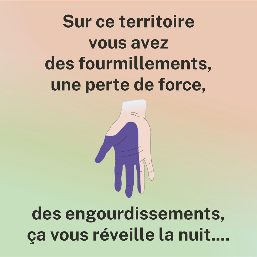 Sur ce territoire, vous avez des fourmillements, une perte de force, des engourdissements, ça vous réveille la nuit. Schéma de la main avec le territoire du nerf médian coloré : pouce, index, majeur et moitié de l'annulaire.